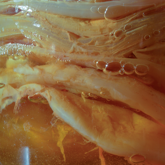 Fermentación acética